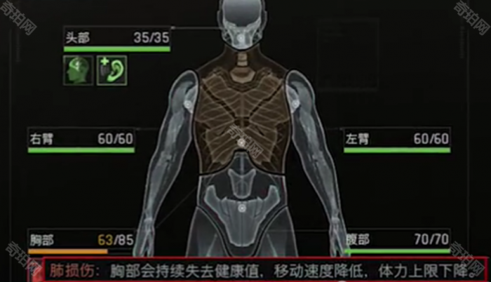 《暗区突围无限》异常状态处理方法4