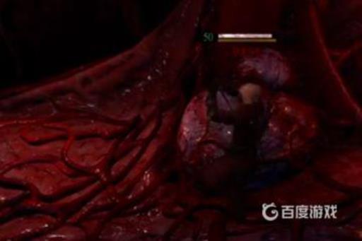 巫师3狄拉夫怎么打?5